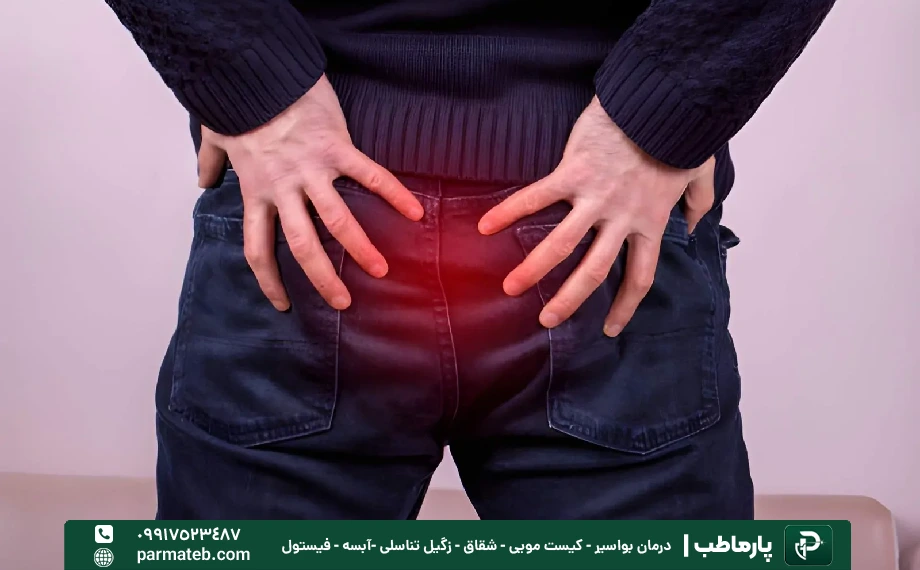 توضیح انواع بواسیر