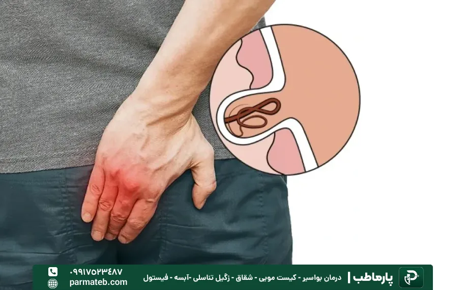 از بین رفتن کیست مویی بدون درمان موثر ممکن نیست
