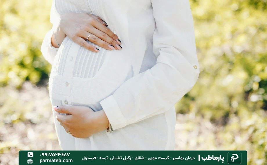 بواسیر در بارداری ممکن است رخ دهد