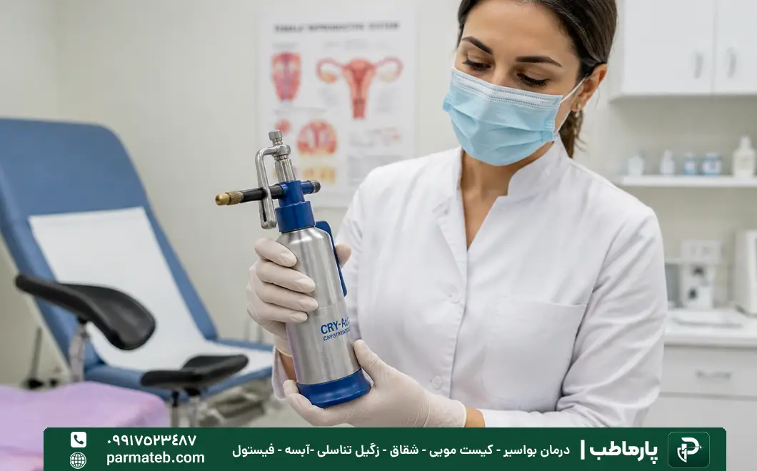 درمان زگیل تناسلی با کرایوتراپی