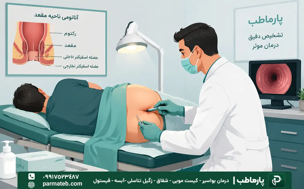 تشخیص و معاینه شقاق مقعدی