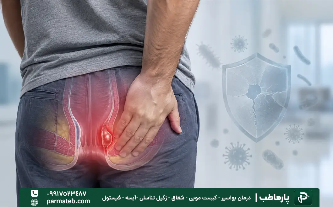 علت آبسه مقعدی