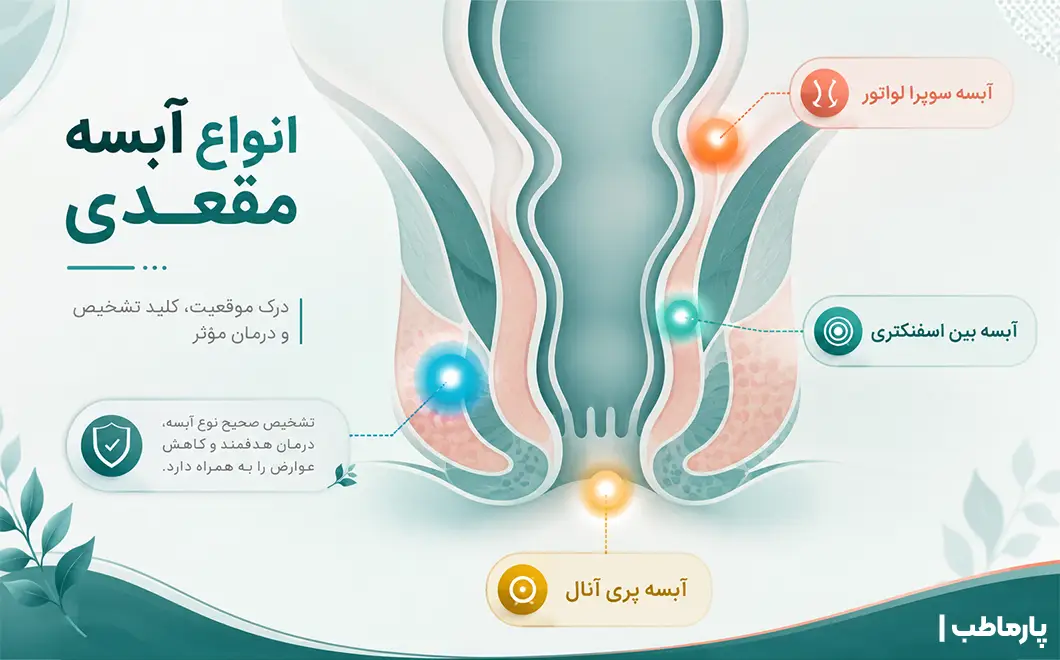انواع آبسه مقعدی