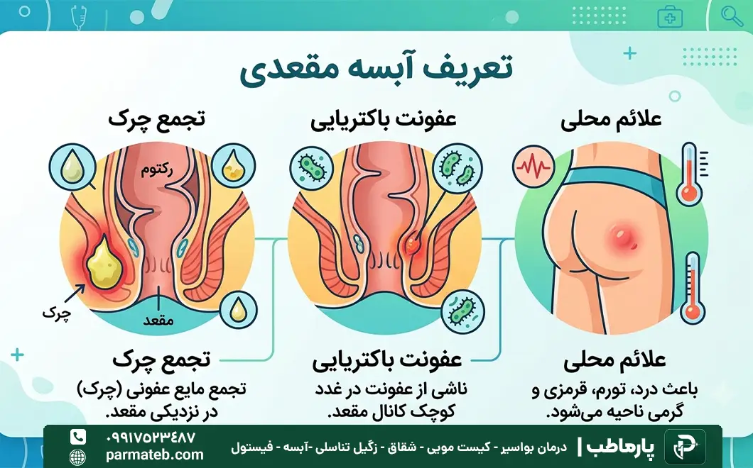 آبسه مقعدی چیست