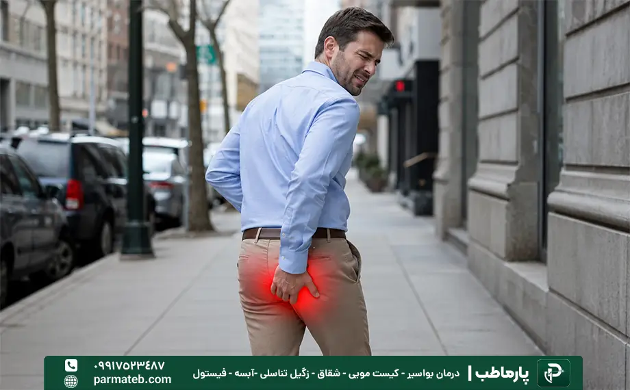 بواسیر در مردان