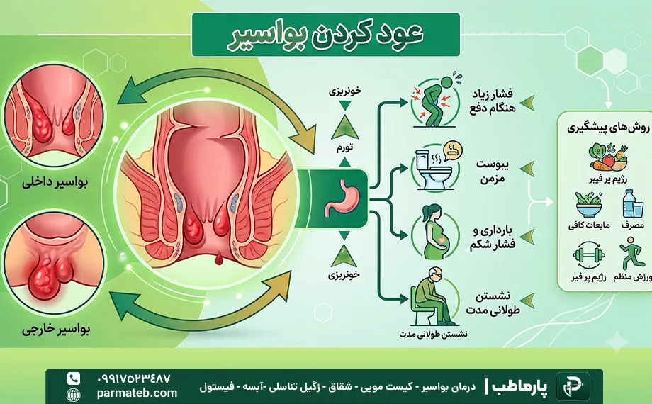 عود بواسیر