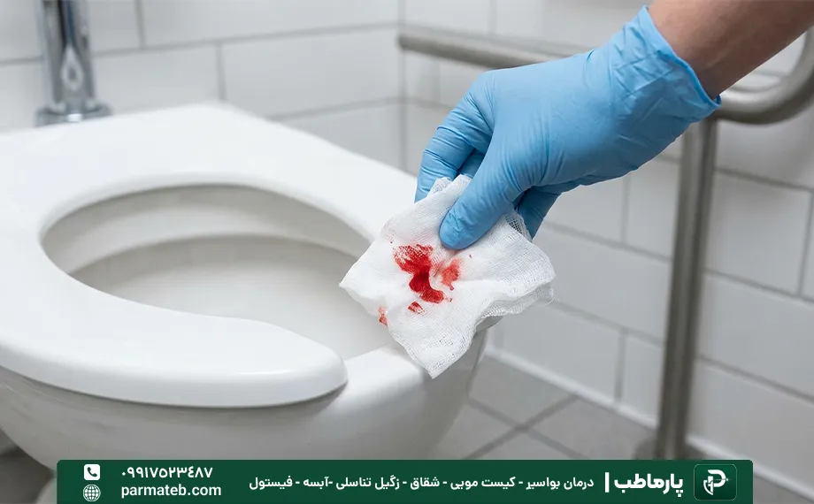 علت خونریزی از مقعد
