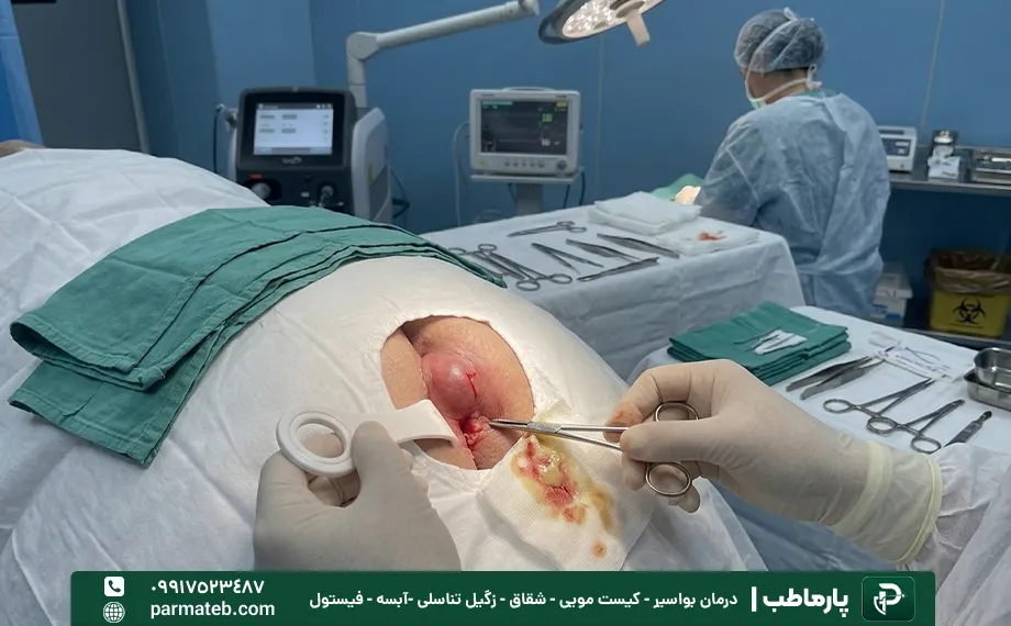 مقایسه درمان آبسه مقعدی با لیزر با جراحی
