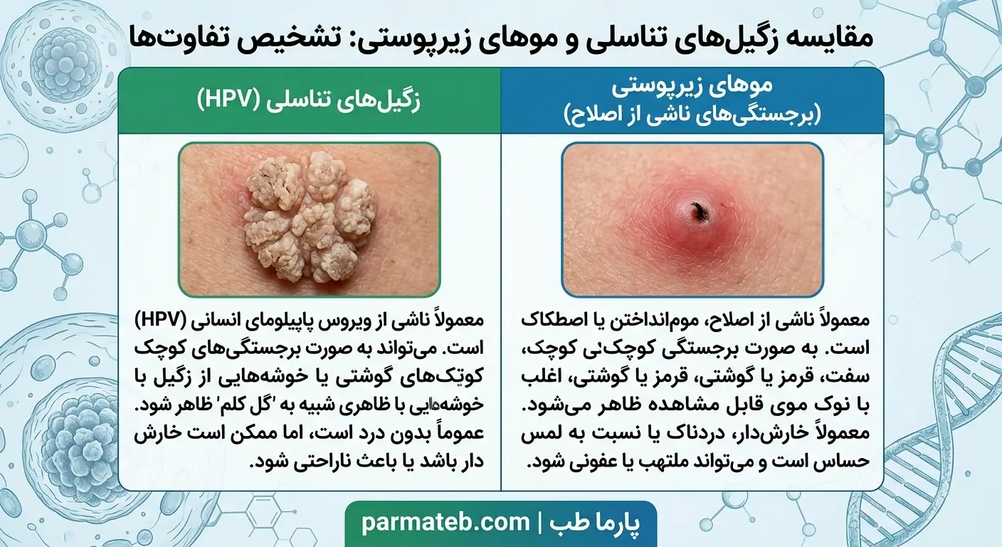 تفاوت زگیل تناسلی با موی زیرپوستی
