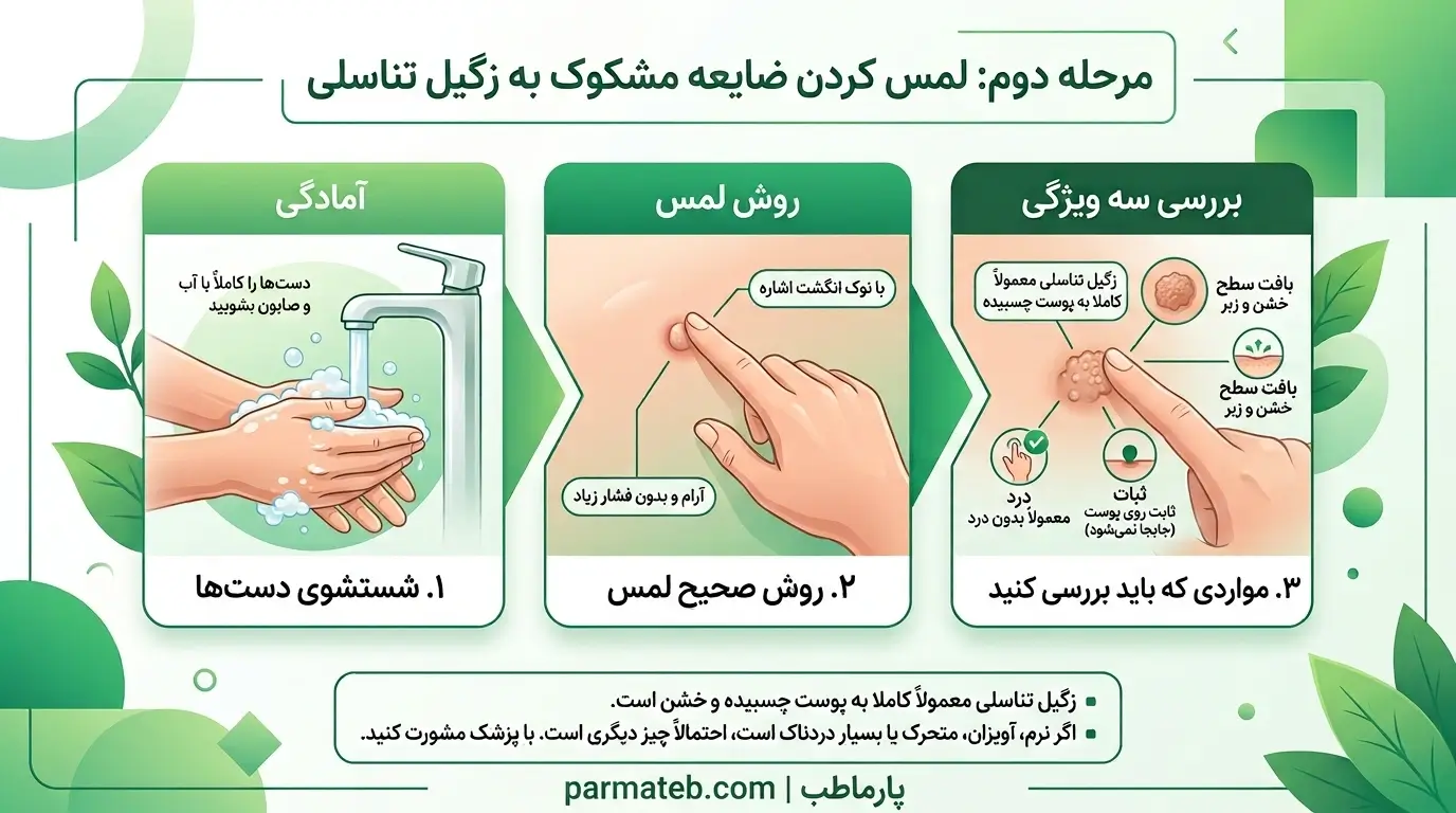 مرحله دوم تشخیص زگیل تناسلی در خانه
