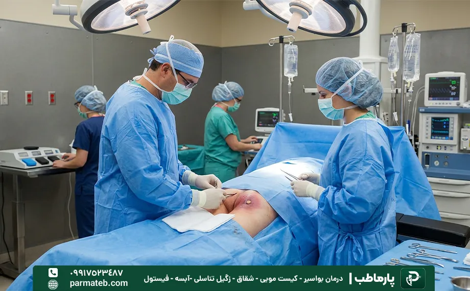 عمل آبسه مقعدی