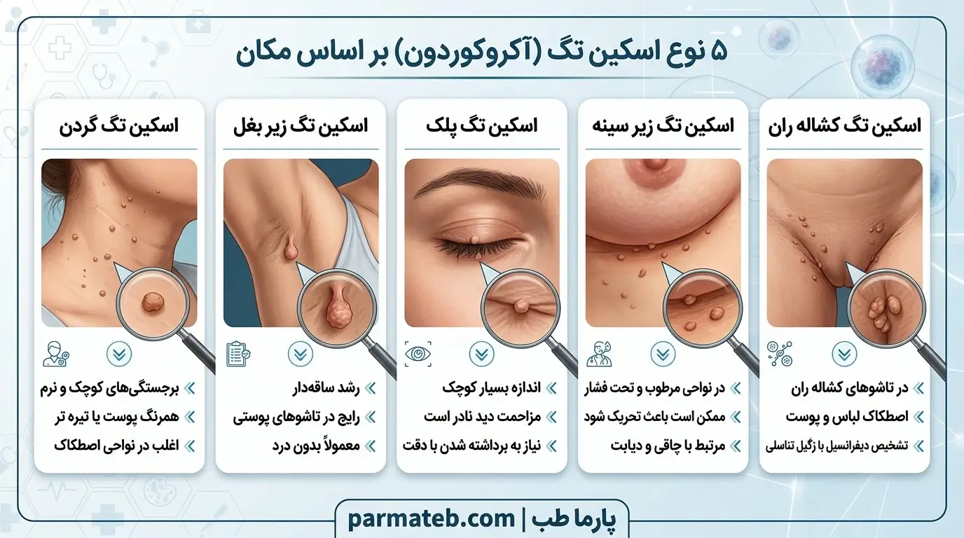 انواع منگوله پوستی