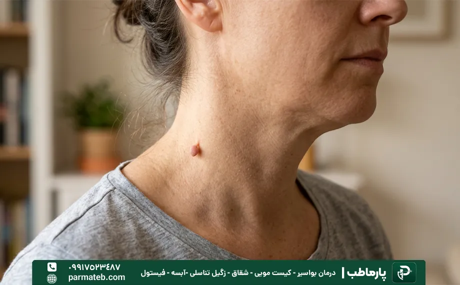 عکس اسکین تگ در زنان
