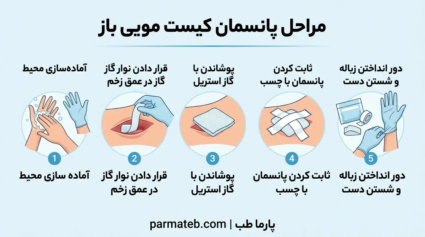 مراحل پانسمان کیست مویی باز