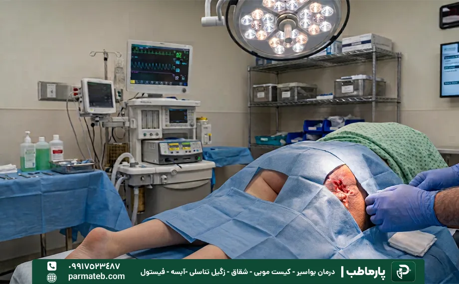 فیستول کودک
