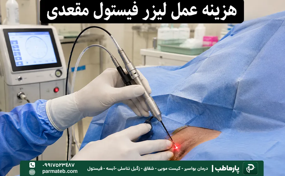 هزینه عمل لیزر فیستول مقعدی