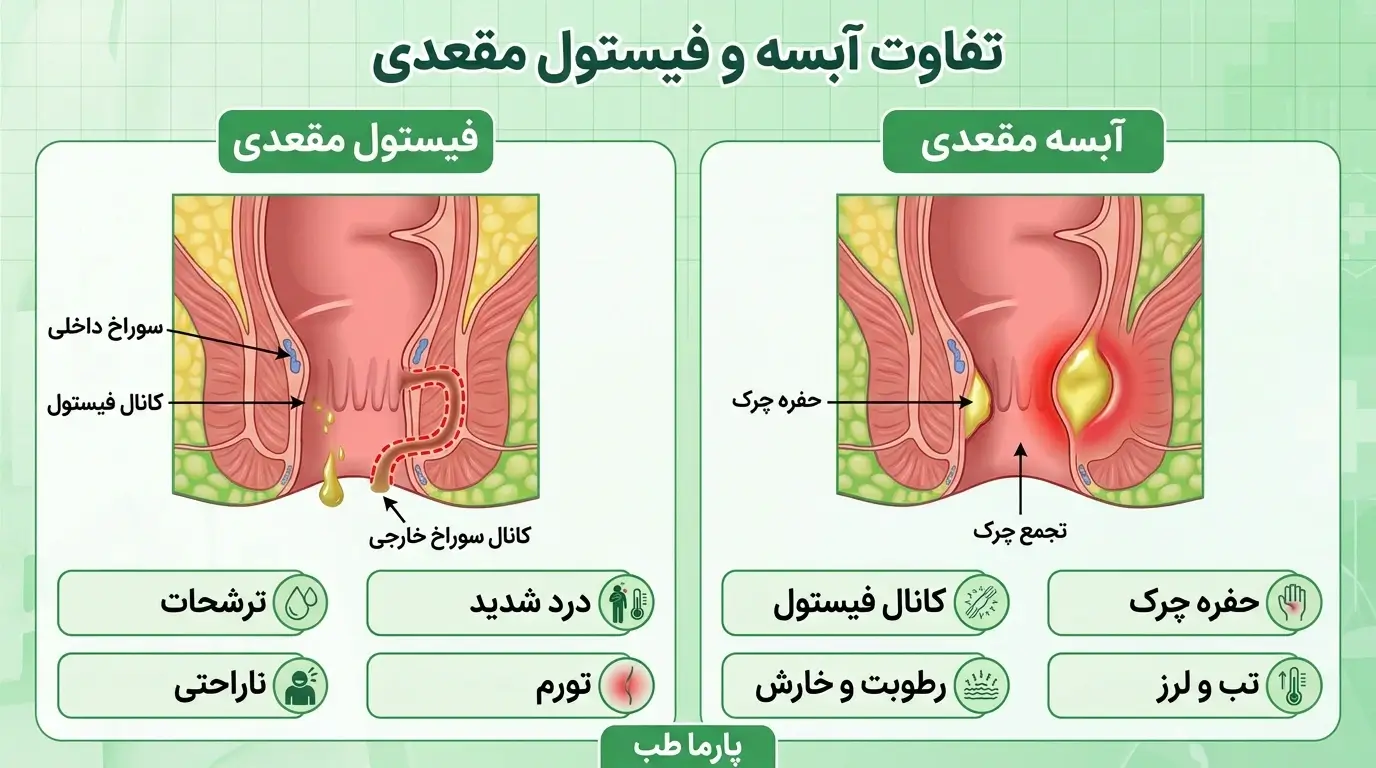 فرق آبسه و فیستول مقعدی