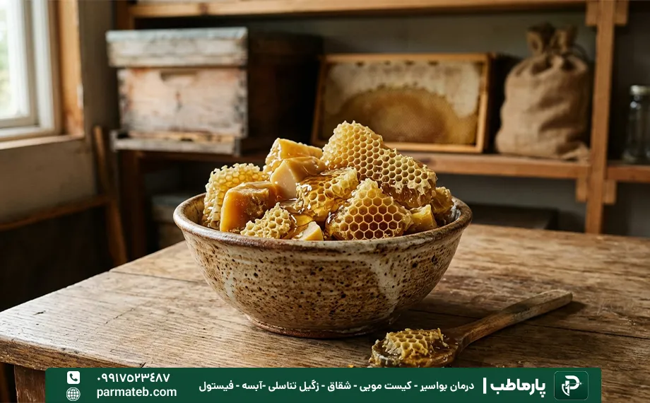 موم زنبور عسل برای درمان خانگی زگیل تناسلی