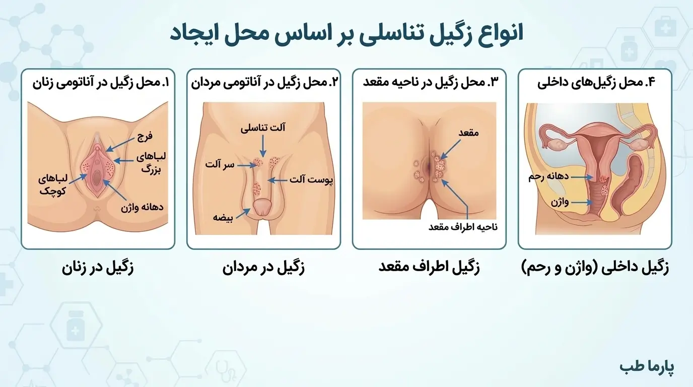 انواع زگیل تناسلی براساس محل ایجاد