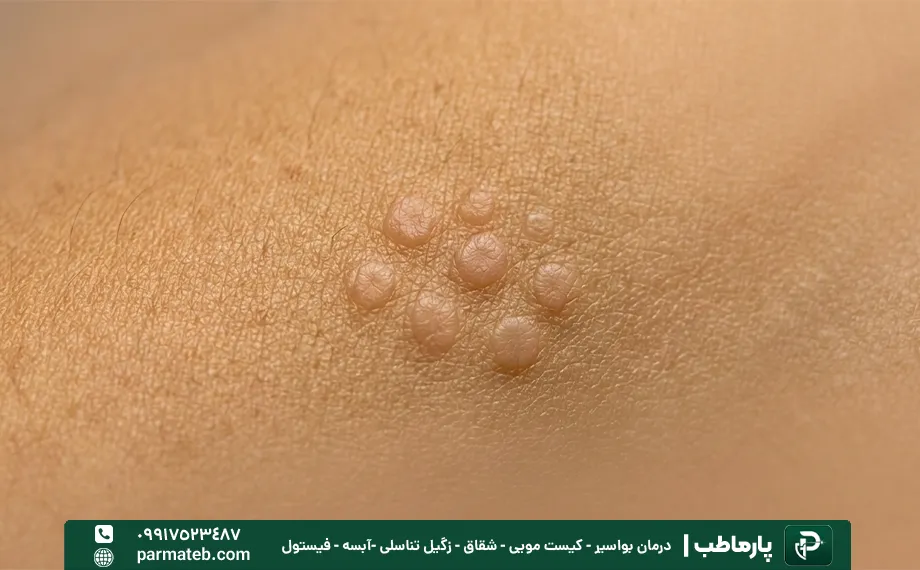 نوع تخت